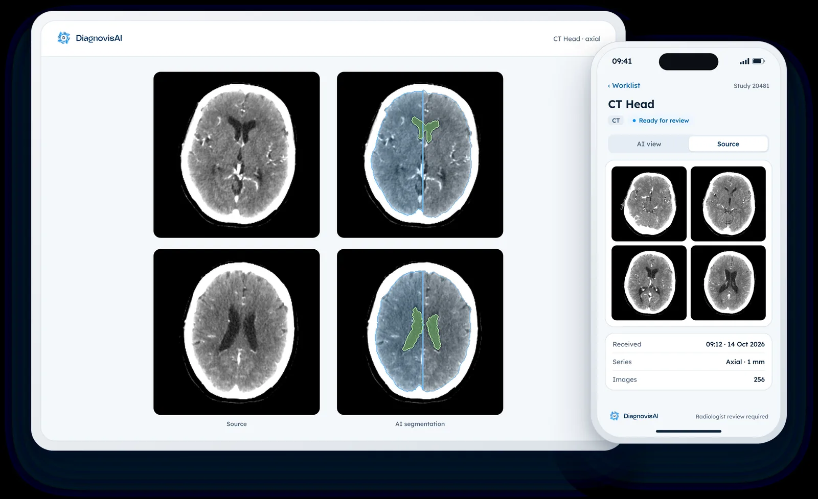 DiagnovisAI interface on tablet and phone showing CT head images with AI segmentation